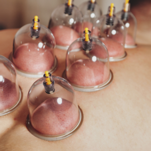 Clinical cupping therapy