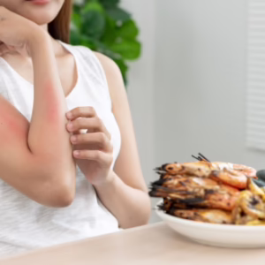 Food Allergen Awareness Training