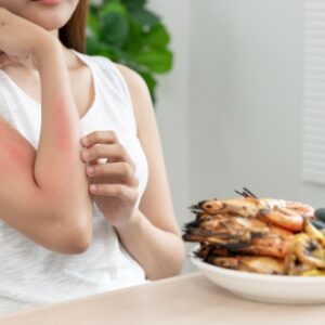 Food Allergen Awareness Training